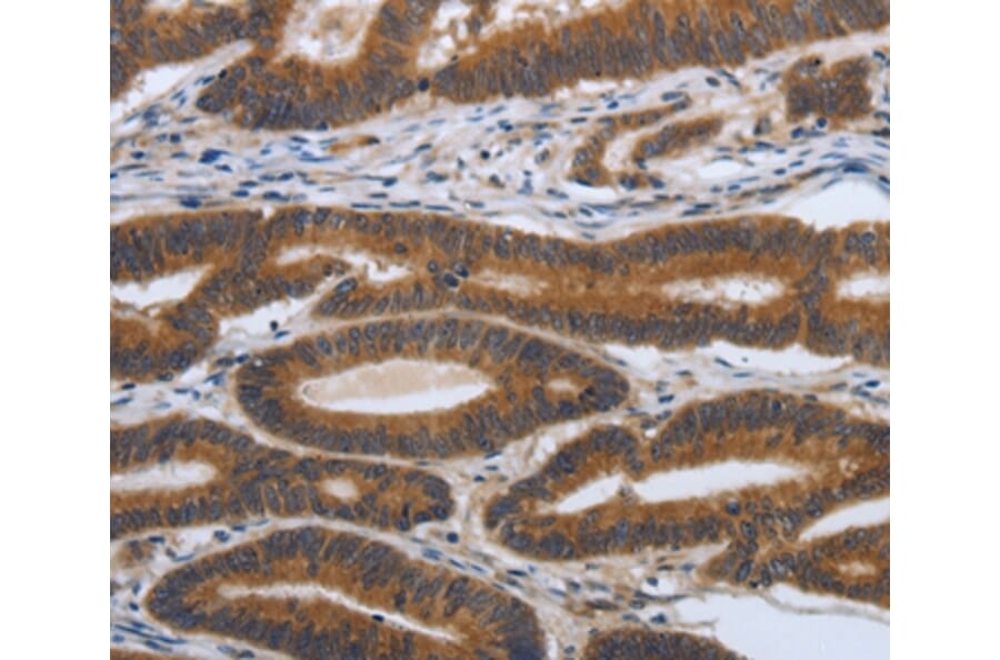 Immunohistochemistry - PDGFA Antibody from Signalway Antibody (37213) - Antibodies.com