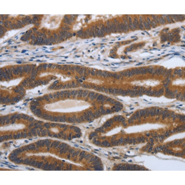 Immunohistochemistry - PDGFA Antibody from Signalway Antibody (37213) - Antibodies.com