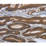 Immunohistochemistry - PDGFA Antibody from Signalway Antibody (37213) - Antibodies.com