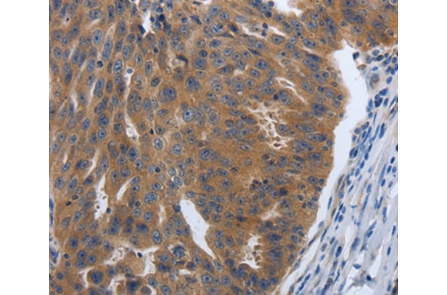 Immunohistochemistry - PDGFA Antibody from Signalway Antibody (37213) - Antibodies.com