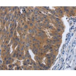 Immunohistochemistry - PDGFA Antibody from Signalway Antibody (37213) - Antibodies.com