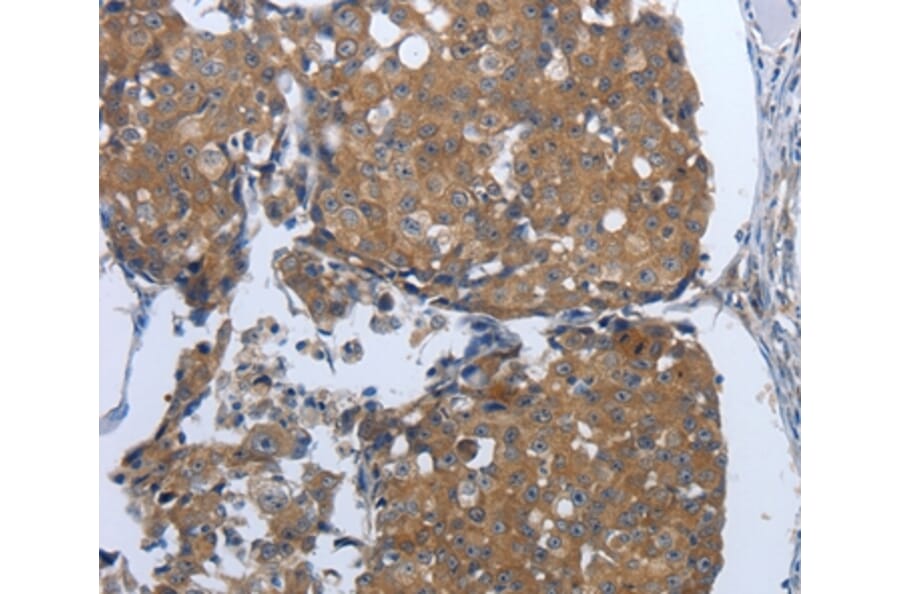 Immunohistochemistry - PDIA2 Antibody from Signalway Antibody (37214) - Antibodies.com