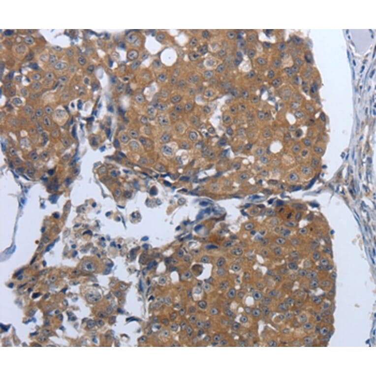 Immunohistochemistry - PDIA2 Antibody from Signalway Antibody (37214) - Antibodies.com