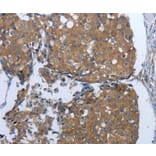 Immunohistochemistry - PDIA2 Antibody from Signalway Antibody (37214) - Antibodies.com