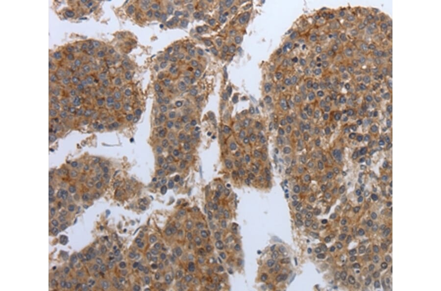 Immunohistochemistry - PDIA2 Antibody from Signalway Antibody (37214) - Antibodies.com