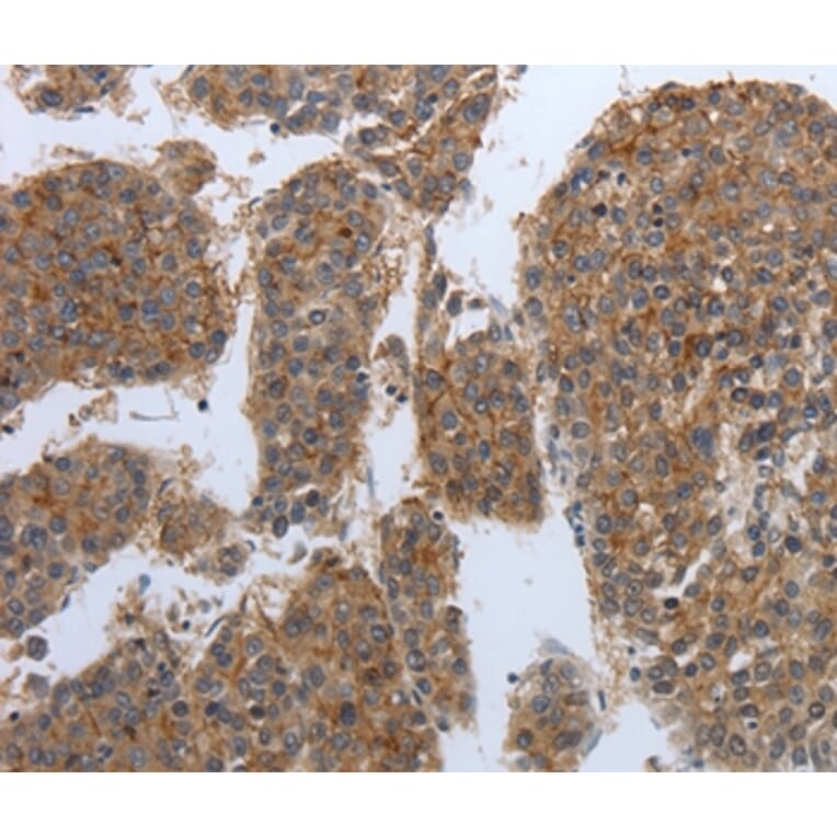 Immunohistochemistry - PDIA2 Antibody from Signalway Antibody (37214) - Antibodies.com