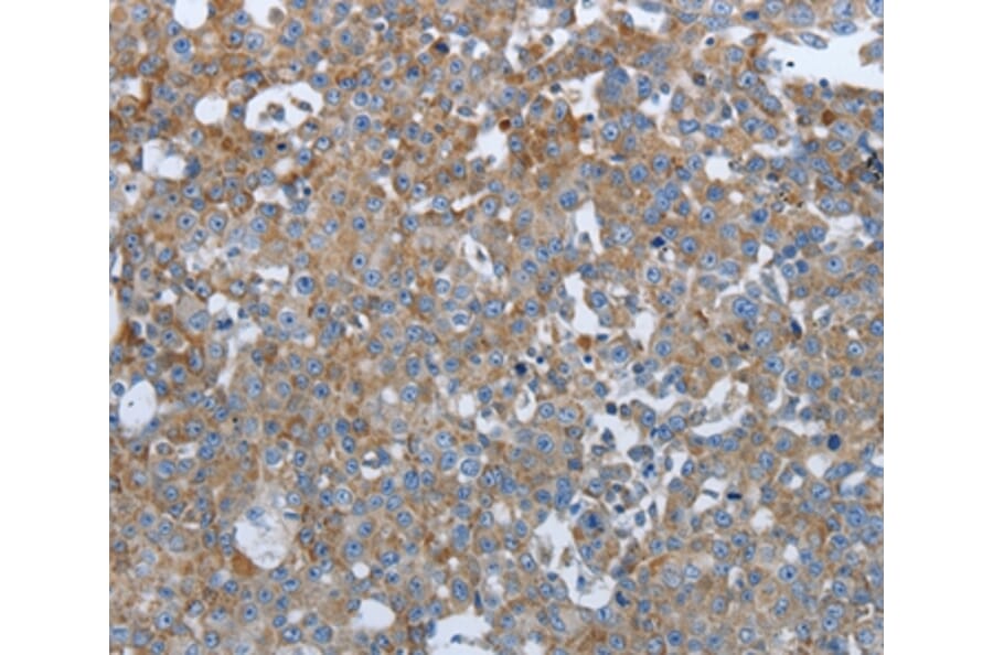 Immunohistochemistry - PTPRJ Antibody from Signalway Antibody (37226) - Antibodies.com
