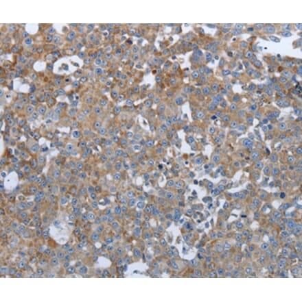 Immunohistochemistry - PTPRJ Antibody from Signalway Antibody (37226) - Antibodies.com