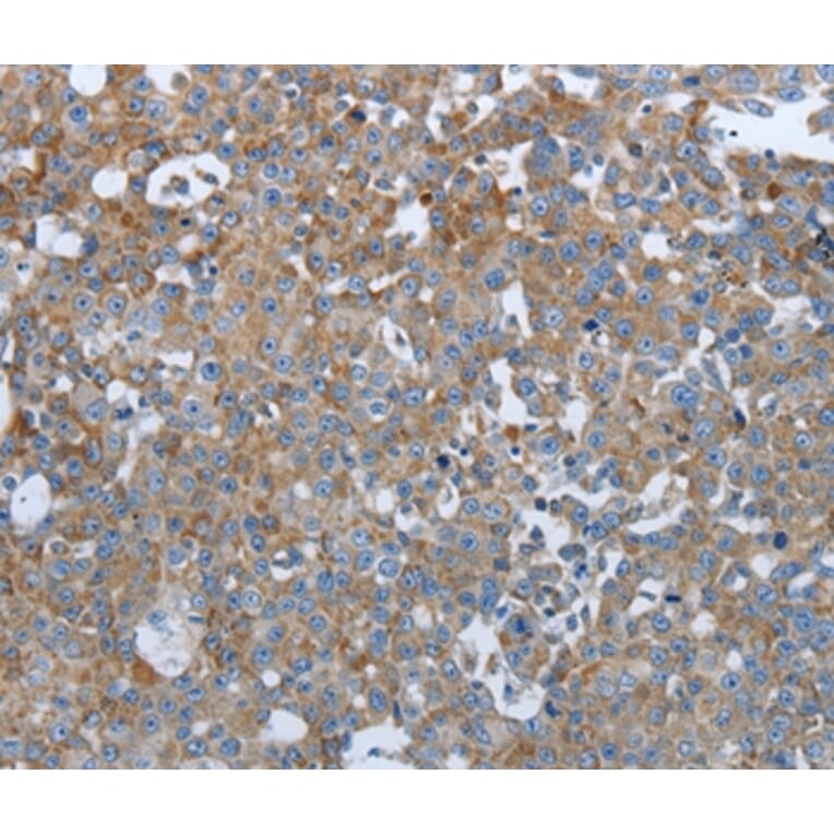 Immunohistochemistry - PTPRJ Antibody from Signalway Antibody (37226) - Antibodies.com
