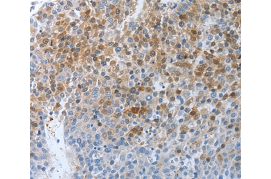 Immunohistochemistry - PTPRJ Antibody from Signalway Antibody (37226) - Antibodies.com