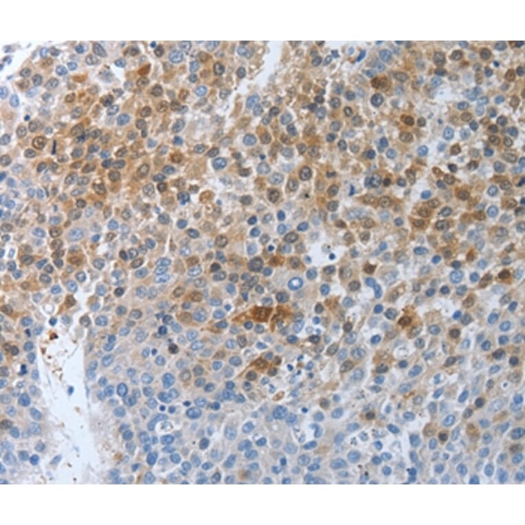 Immunohistochemistry - PTPRJ Antibody from Signalway Antibody (37226) - Antibodies.com