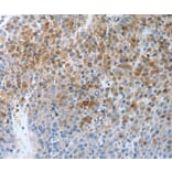 Immunohistochemistry - PTPRJ Antibody from Signalway Antibody (37226) - Antibodies.com
