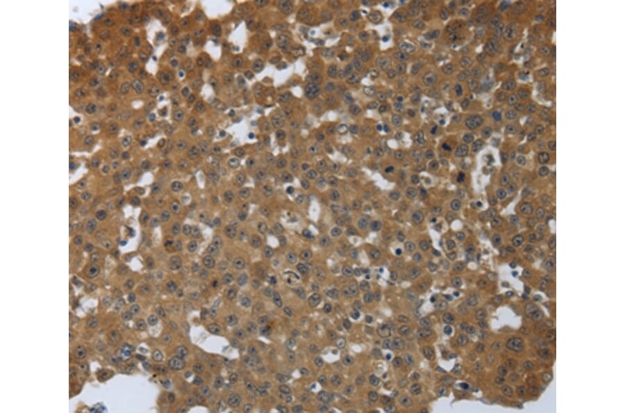 Immunohistochemistry - PTPRM Antibody from Signalway Antibody (37227) - Antibodies.com