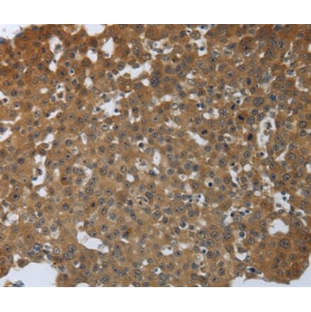 Immunohistochemistry - PTPRM Antibody from Signalway Antibody (37227) - Antibodies.com