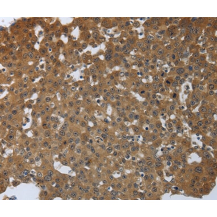 Immunohistochemistry - PTPRM Antibody from Signalway Antibody (37227) - Antibodies.com