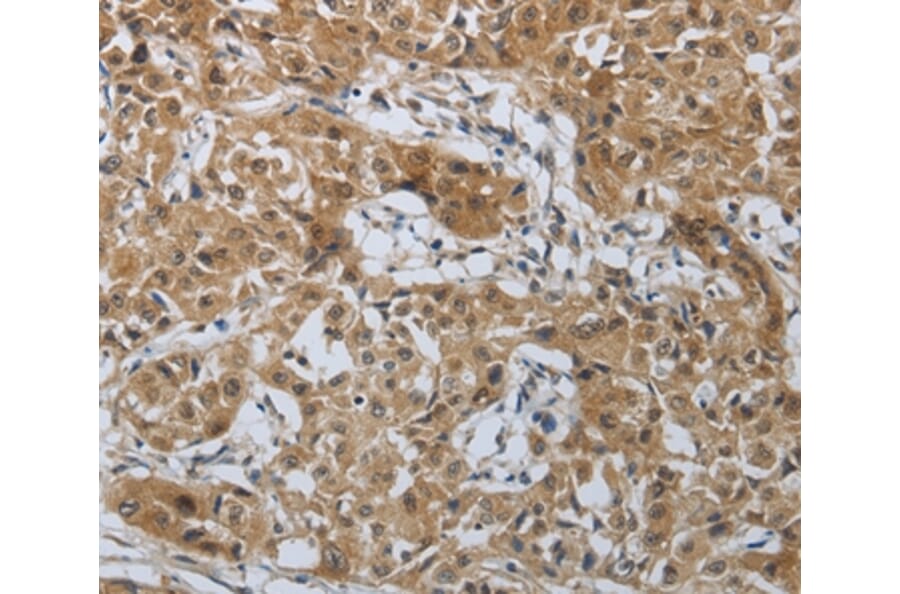 Immunohistochemistry - PTPRM Antibody from Signalway Antibody (37227) - Antibodies.com
