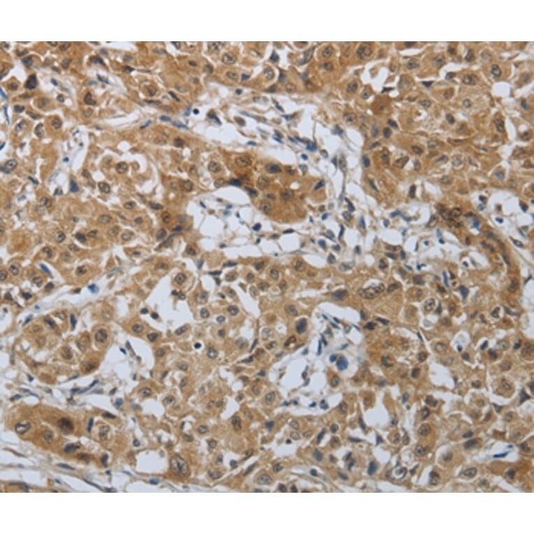 Immunohistochemistry - PTPRM Antibody from Signalway Antibody (37227) - Antibodies.com