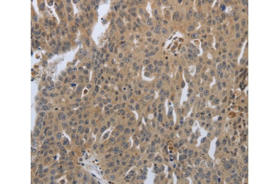 Immunohistochemistry - PTPRT Antibody from Signalway Antibody (37228) - Antibodies.com