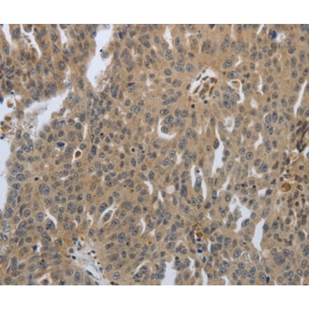 Immunohistochemistry - PTPRT Antibody from Signalway Antibody (37228) - Antibodies.com