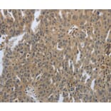 Immunohistochemistry - PTPRT Antibody from Signalway Antibody (37228) - Antibodies.com