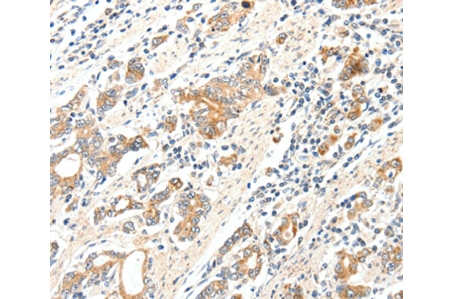 Immunohistochemistry - SCN2A Antibody from Signalway Antibody (37232) - Antibodies.com