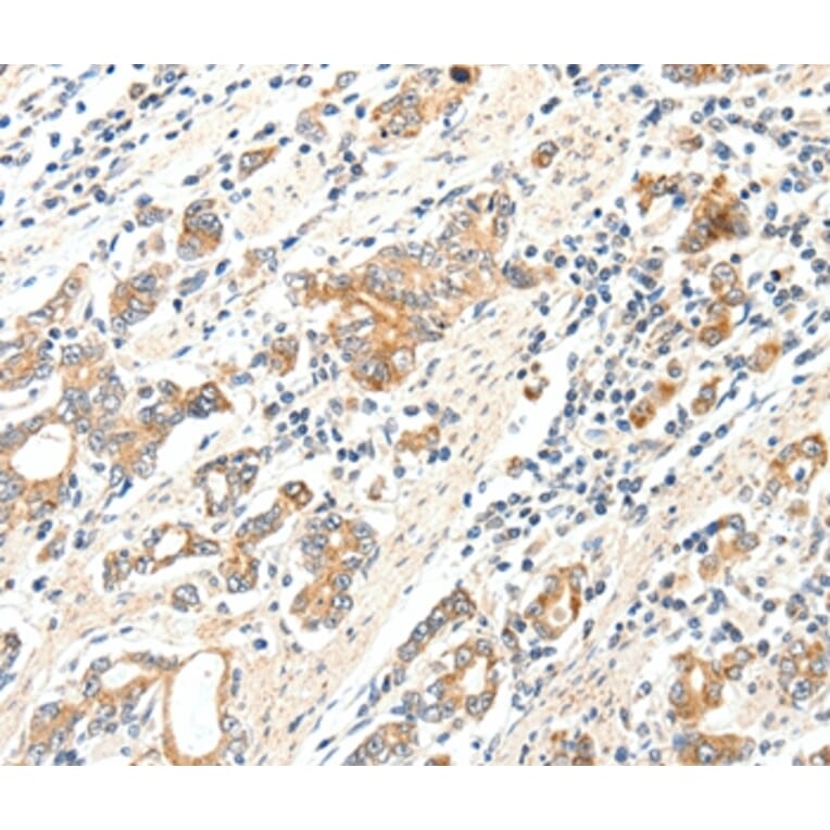 Immunohistochemistry - SCN2A Antibody from Signalway Antibody (37232) - Antibodies.com