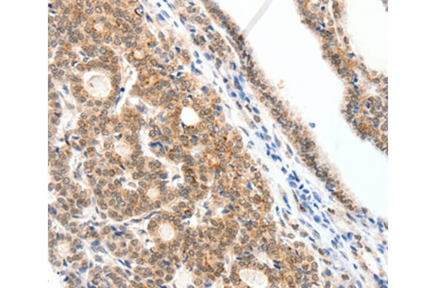 Immunohistochemistry - SCN2A Antibody from Signalway Antibody (37232) - Antibodies.com