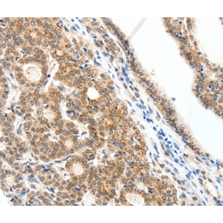 Immunohistochemistry - SCN2A Antibody from Signalway Antibody (37232) - Antibodies.com