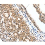 Immunohistochemistry - SCN2A Antibody from Signalway Antibody (37232) - Antibodies.com