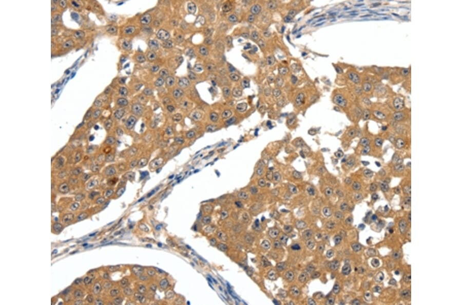 Immunohistochemistry - SCN5A Antibody from Signalway Antibody (37233) - Antibodies.com