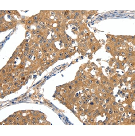 Immunohistochemistry - SCN5A Antibody from Signalway Antibody (37233) - Antibodies.com