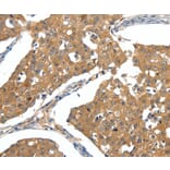 Immunohistochemistry - SCN5A Antibody from Signalway Antibody (37233) - Antibodies.com