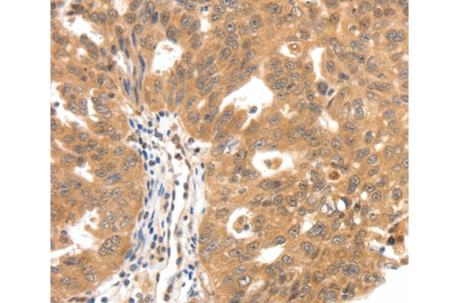 Immunohistochemistry - SCN5A Antibody from Signalway Antibody (37233) - Antibodies.com