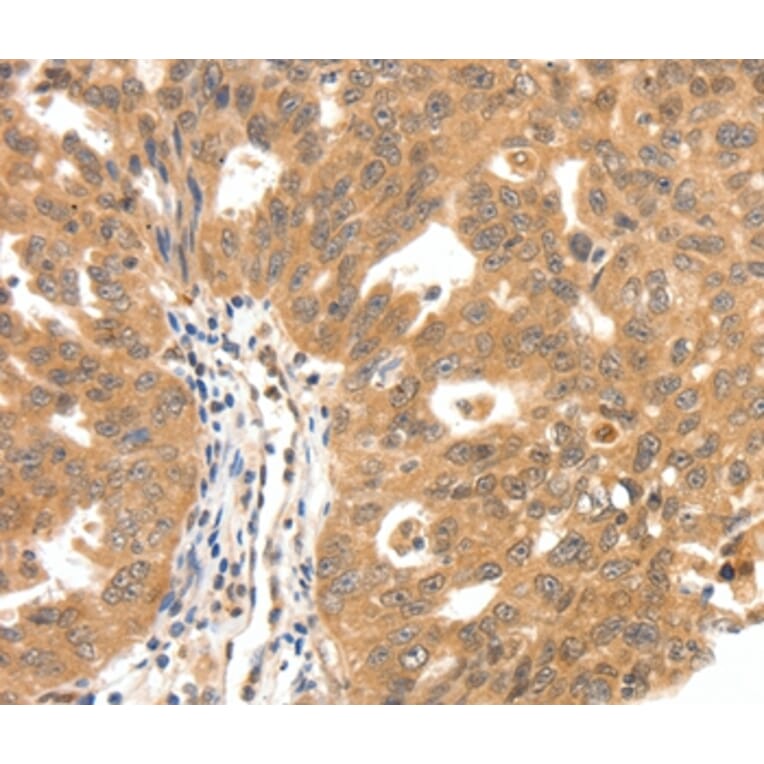 Immunohistochemistry - SCN5A Antibody from Signalway Antibody (37233) - Antibodies.com