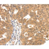 Immunohistochemistry - SCN5A Antibody from Signalway Antibody (37233) - Antibodies.com