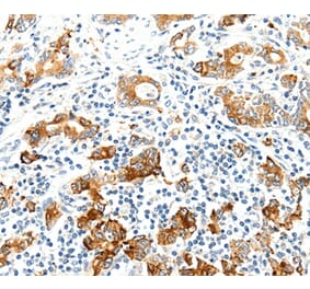 Immunohistochemistry - SEL1L Antibody from Signalway Antibody (37238) - Antibodies.com