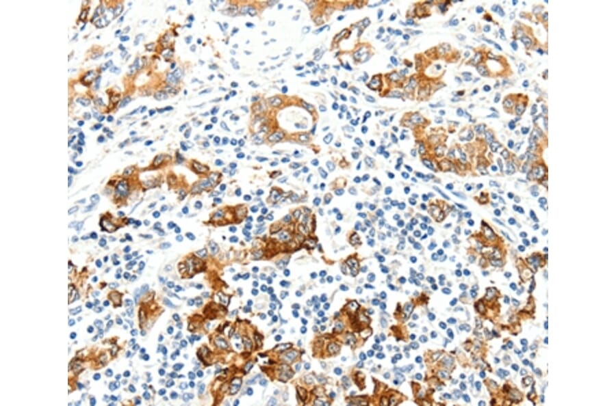 Immunohistochemistry - SEL1L Antibody from Signalway Antibody (37238) - Antibodies.com