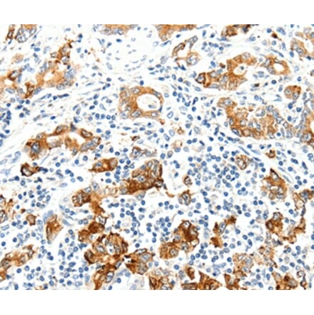 Immunohistochemistry - SEL1L Antibody from Signalway Antibody (37238) - Antibodies.com