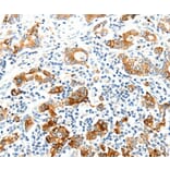 Immunohistochemistry - SEL1L Antibody from Signalway Antibody (37238) - Antibodies.com