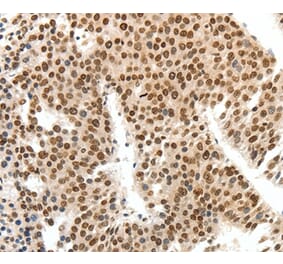 Immunohistochemistry - SIPA1 Antibody from Signalway Antibody (37252) - Antibodies.com