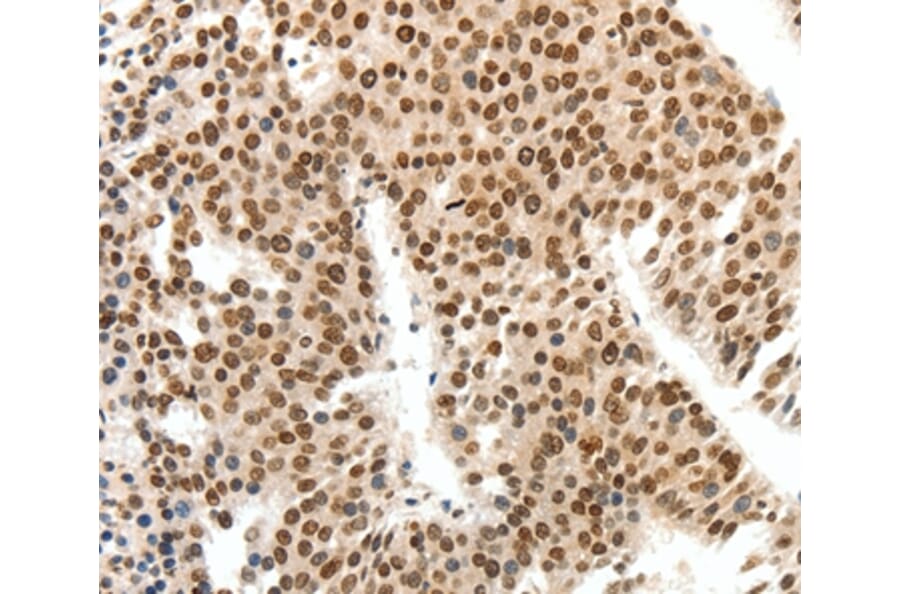 Immunohistochemistry - SIPA1 Antibody from Signalway Antibody (37252) - Antibodies.com