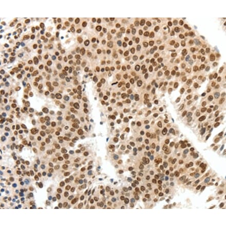 Immunohistochemistry - SIPA1 Antibody from Signalway Antibody (37252) - Antibodies.com