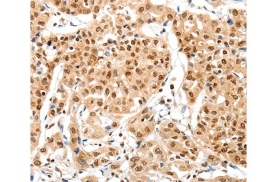 Immunohistochemistry - SIPA1 Antibody from Signalway Antibody (37252) - Antibodies.com