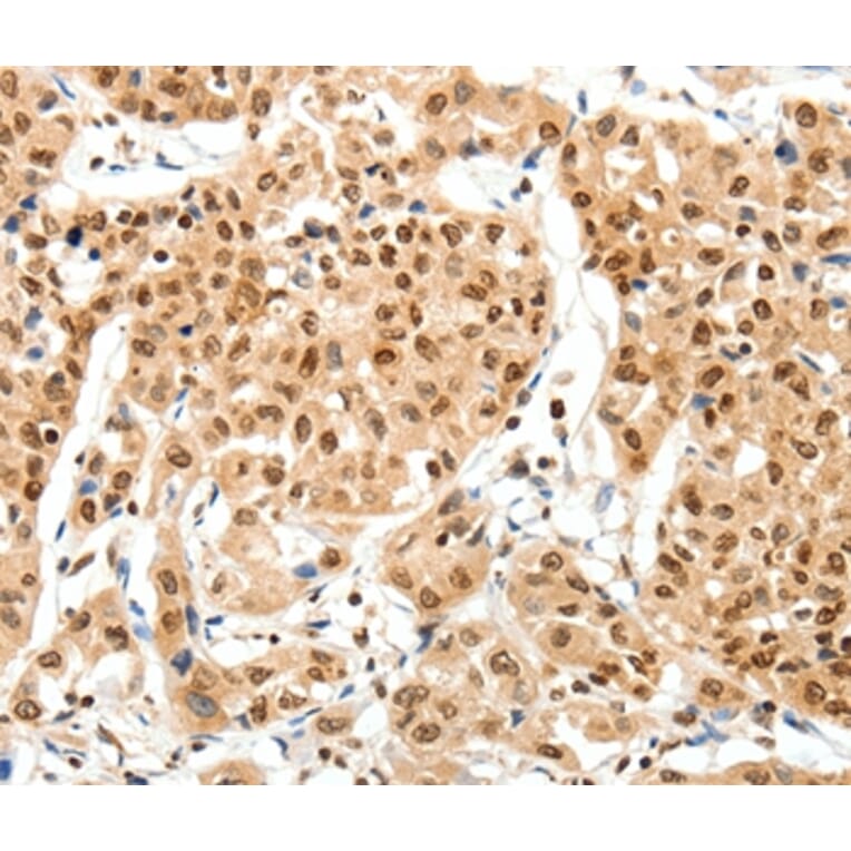 Immunohistochemistry - SIPA1 Antibody from Signalway Antibody (37252) - Antibodies.com