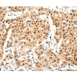 Immunohistochemistry - SIPA1 Antibody from Signalway Antibody (37252) - Antibodies.com