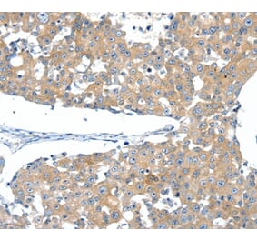 Immunohistochemistry - SSTR3 Antibody from Signalway Antibody (37258) - Antibodies.com