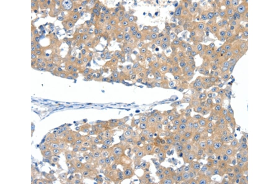 Immunohistochemistry - SSTR3 Antibody from Signalway Antibody (37258) - Antibodies.com