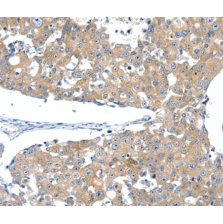 Immunohistochemistry - SSTR3 Antibody from Signalway Antibody (37258) - Antibodies.com