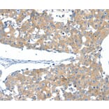 Immunohistochemistry - SSTR3 Antibody from Signalway Antibody (37258) - Antibodies.com