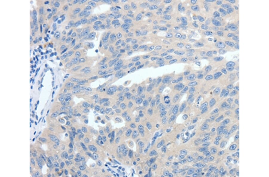 Immunohistochemistry - SSTR3 Antibody from Signalway Antibody (37258) - Antibodies.com